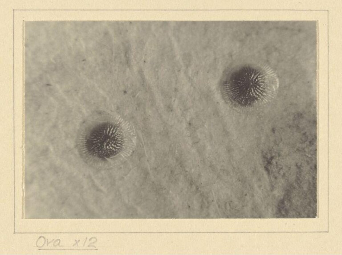 12x Magnified Ova Micrograph