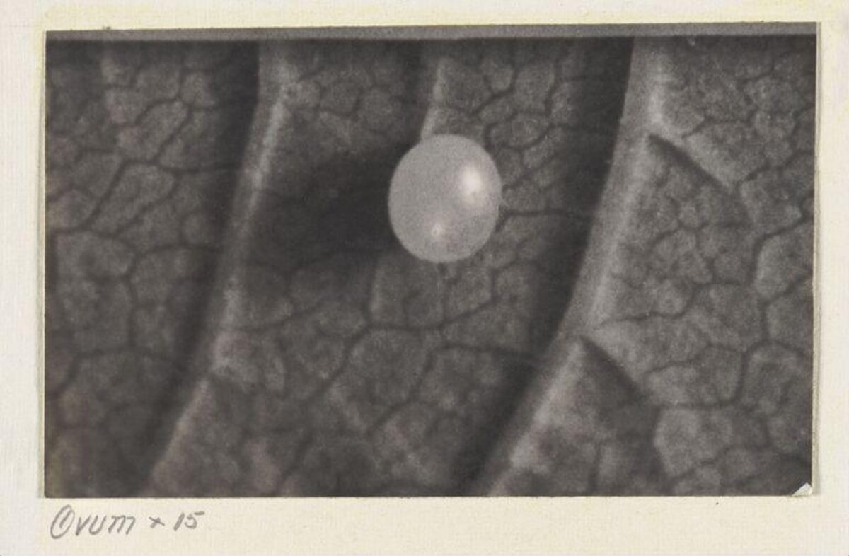 15x Magnified Ovum Micrograph