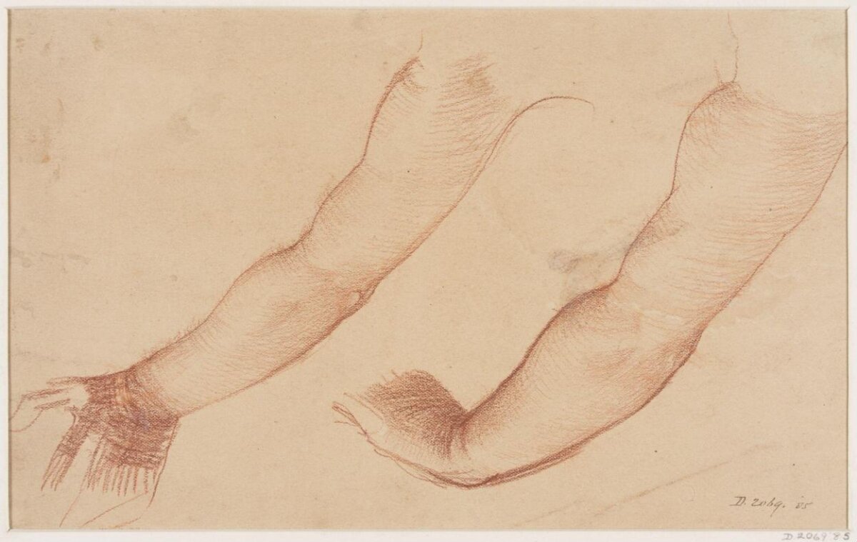 Study Sketch of Two Arms