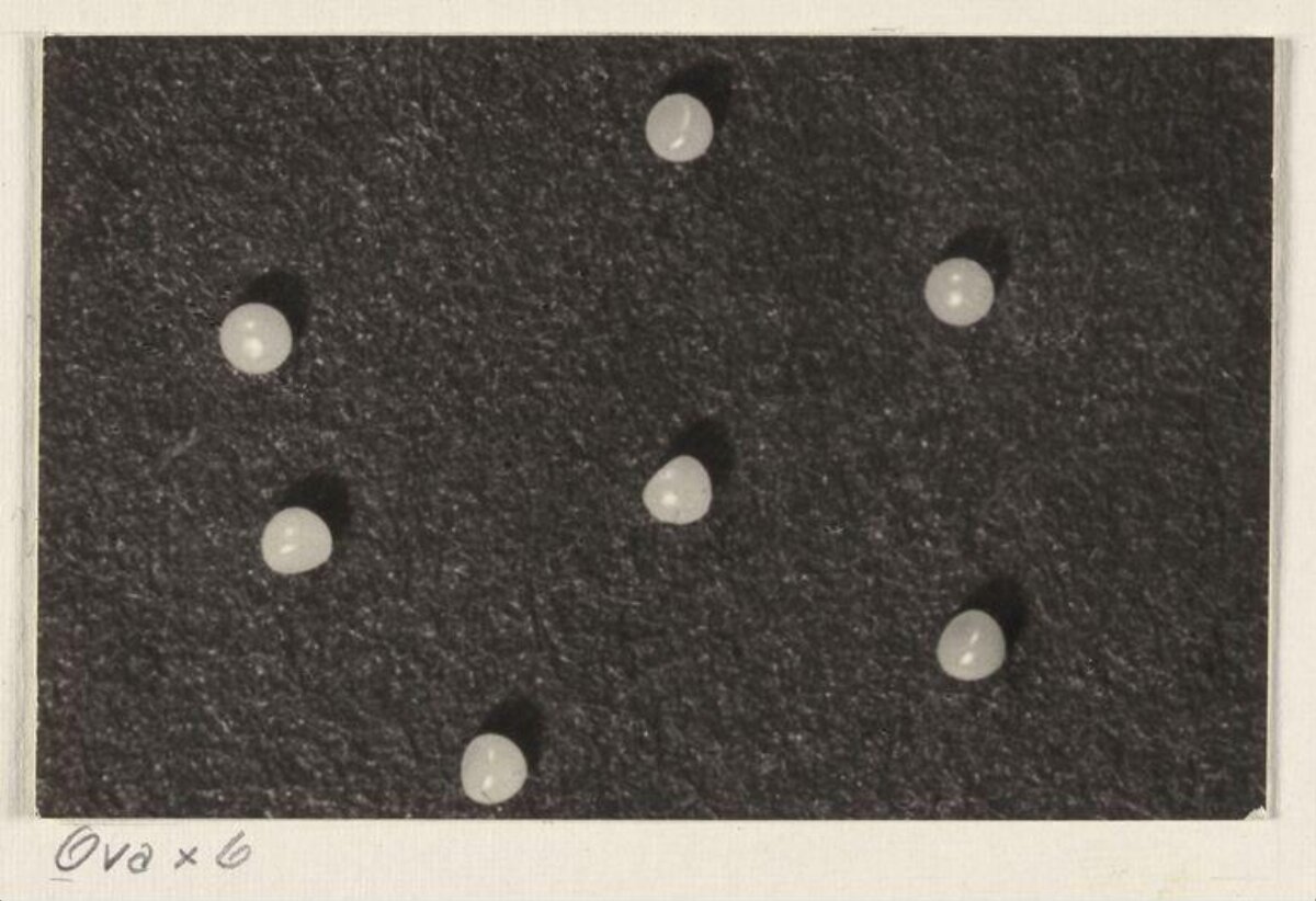 Magnified Ova Biological Specimen