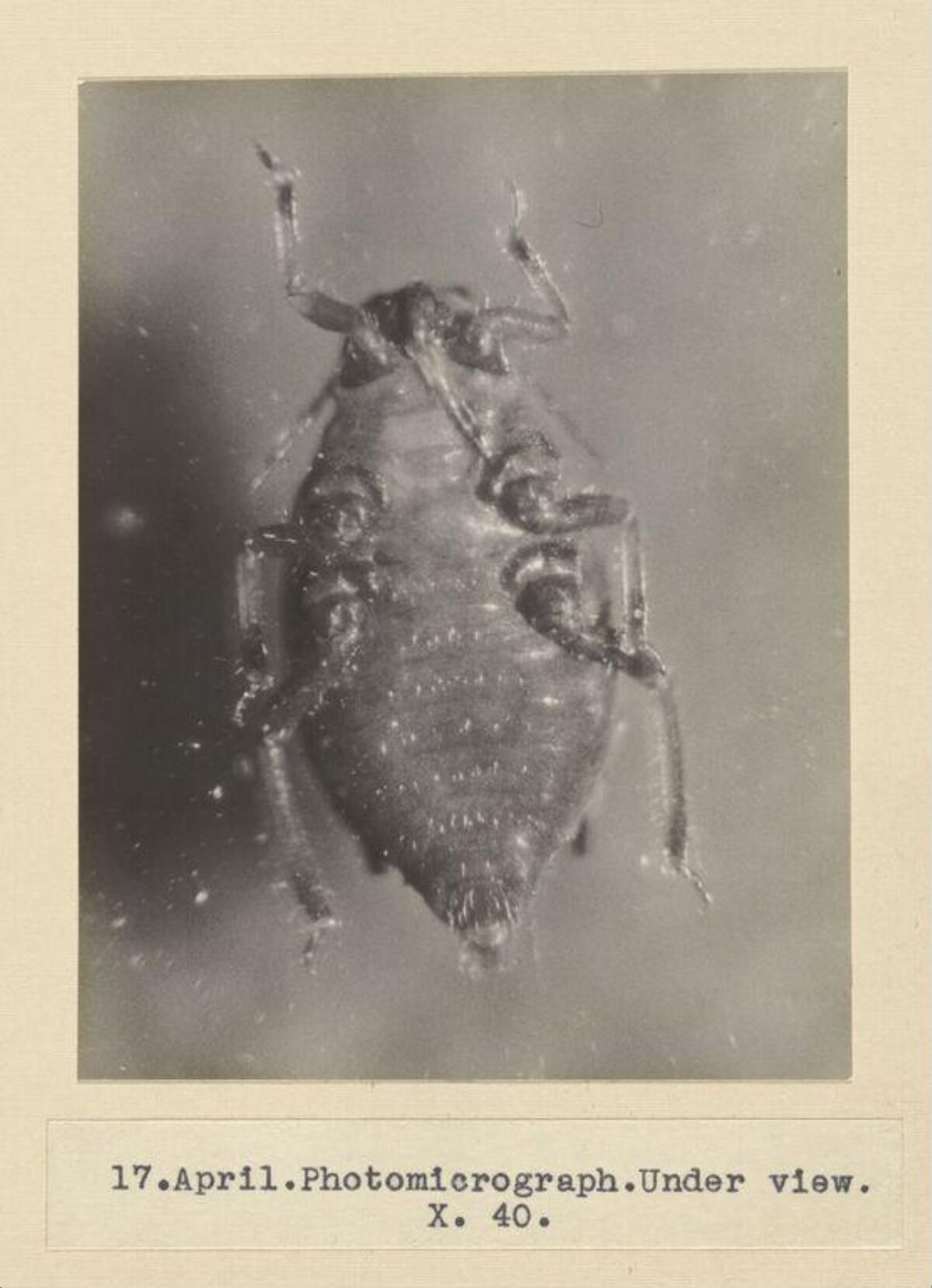 40x Underside View Aphid Photomicrograph
