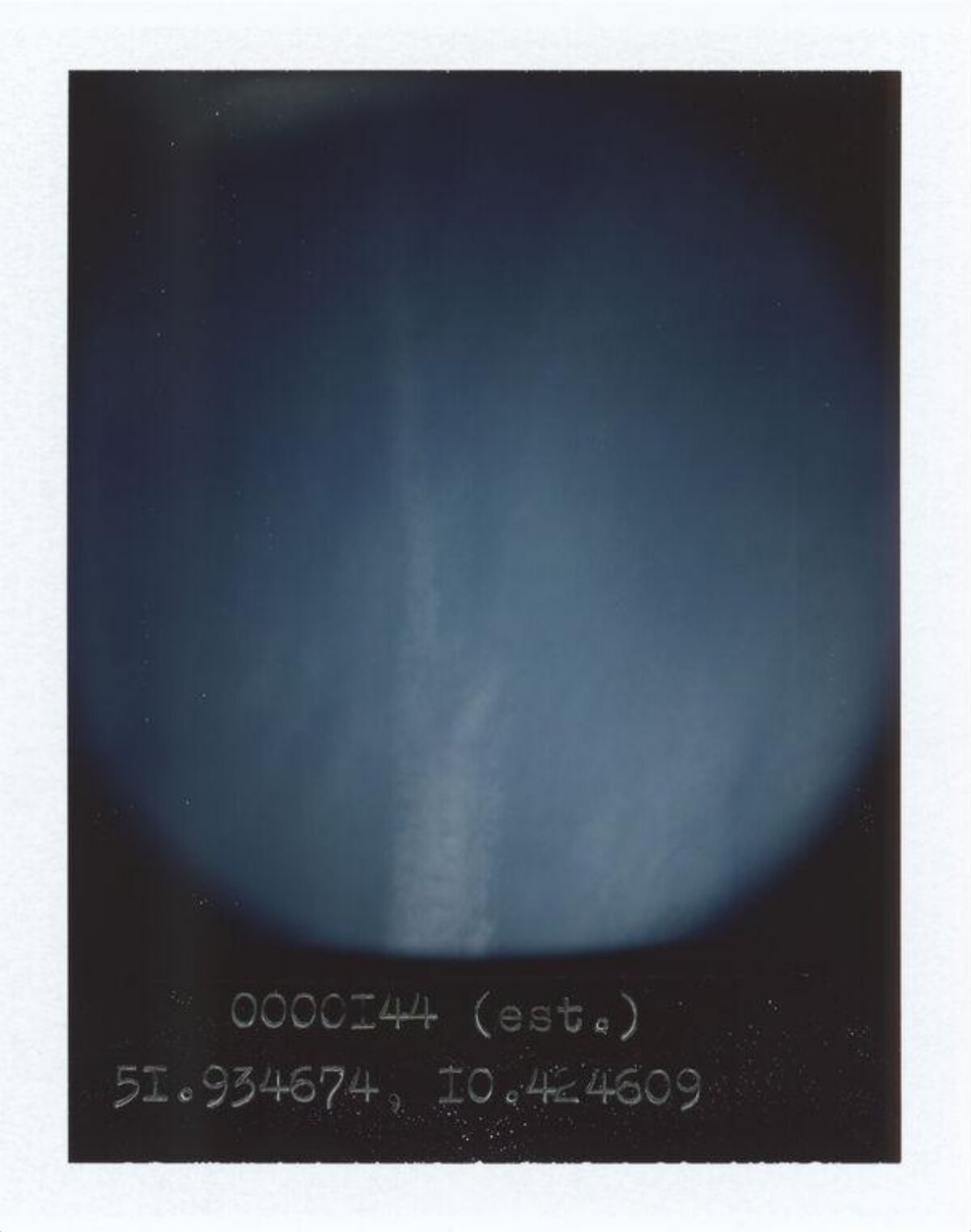 Spine X-ray Film with Coordinates