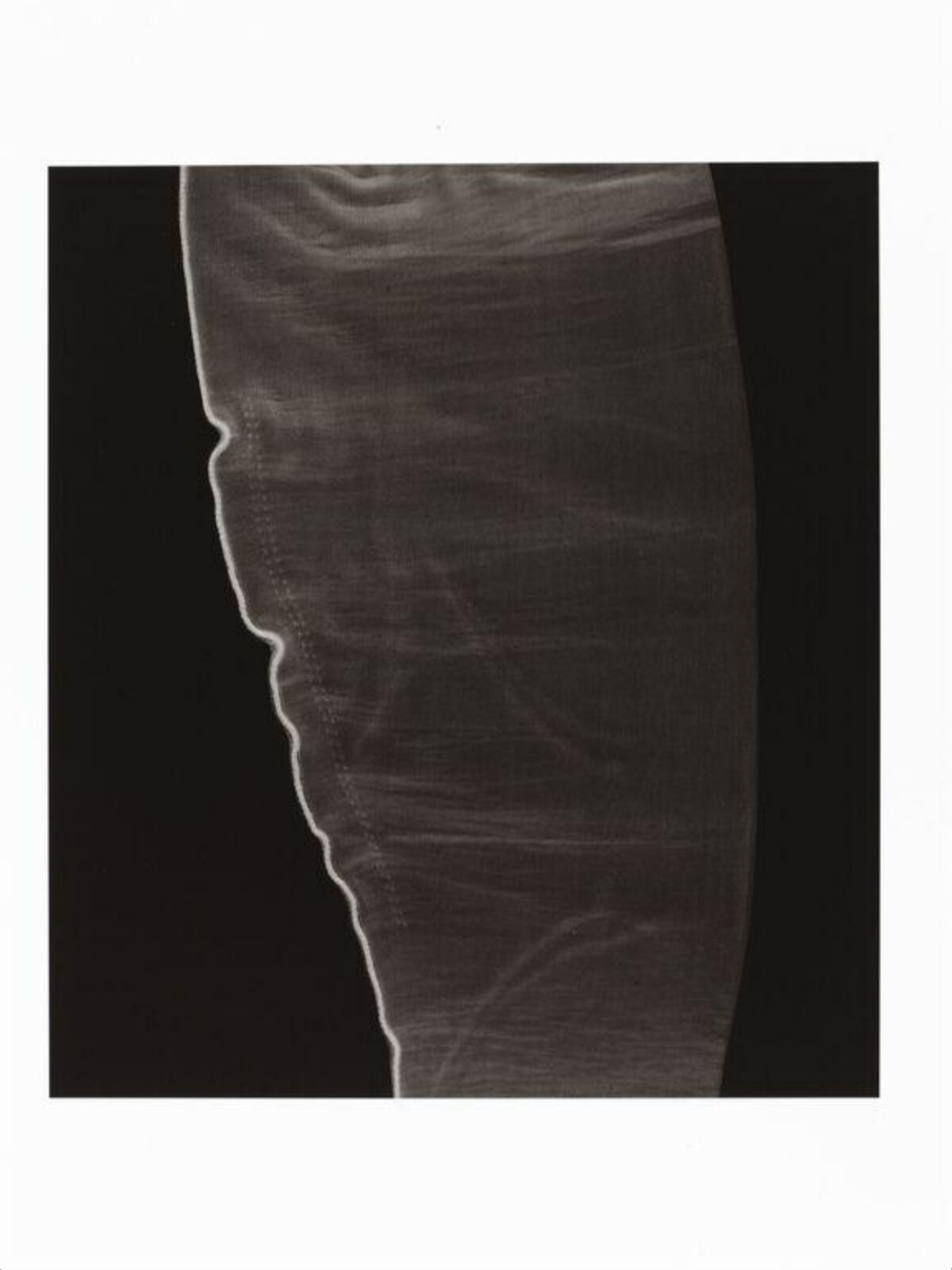 Long Bone Ultrasound Scan
