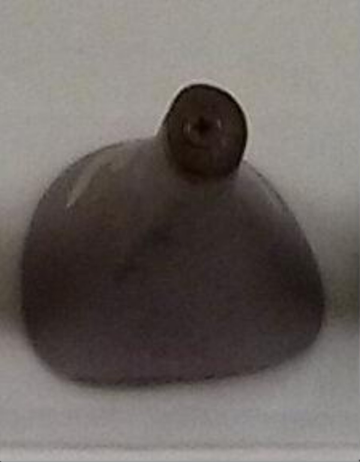 Raised Dark Mole on Skin
