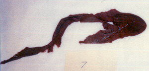 Fossilized Fish Specimen
