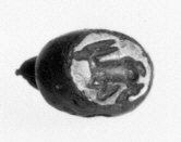 Axial MRI Scan of Human Brain