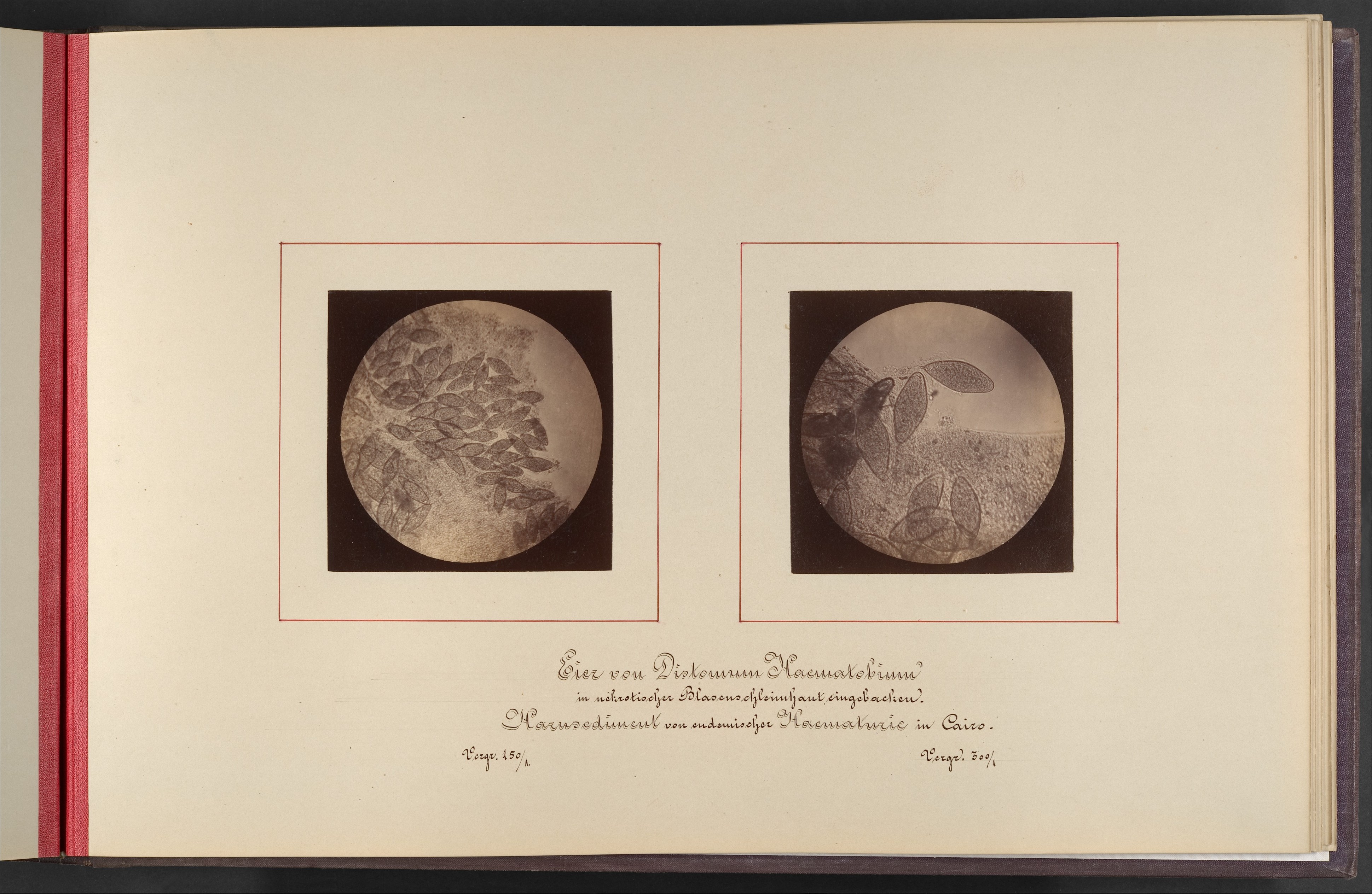 Vintage Micrographs of Parasite Eggs