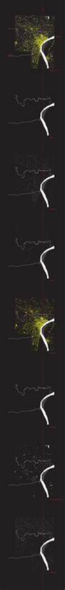 Sequential Neuron Fluorescence Images
